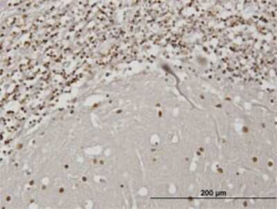 Immunohistochemistry-Paraffin: IBRDC2 Antibody (4F1) [H00255488-M02]