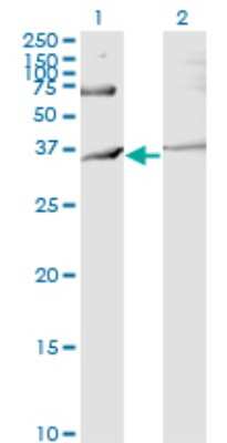 Western Blot: IBRDC2 Antibody (4F1) [H00255488-M02]