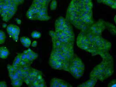 Immunocytochemistry/ Immunofluorescence: IBRDC2 Antibody (OTI9H10) [NBP2-02128]