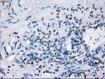 Immunohistochemistry-Paraffin: IBRDC2 Antibody (OTI9H10) [NBP2-02128]