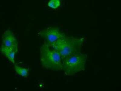 Immunocytochemistry/ Immunofluorescence: IBRDC2 Antibody (OTI9H10) - Azide and BSA Free [NBP2-72470]