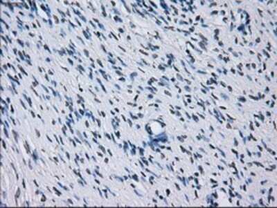 Immunohistochemistry: IBRDC2 Antibody (OTI9H10) - Azide and BSA Free [NBP2-72470]