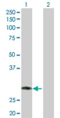 Western Blot: IBRDC2 Antibody [H00255488-D01P]