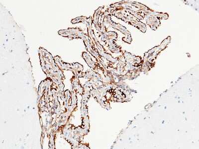 Immunohistochemistry-Paraffin: ICAM-1/CD54 Antibody (020) [NBP2-90586]