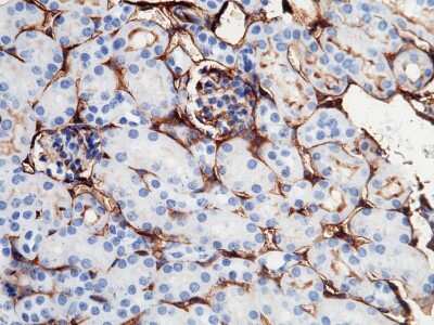 Immunohistochemistry-Paraffin: ICAM-1/CD54 Antibody (020) [NBP2-90586]