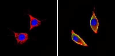 Immunocytochemistry/ Immunofluorescence: ICAM-1/CD54 Antibody (3E2B) - Azide and BSA Free [NBP2-22540]