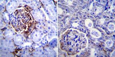 Immunohistochemistry-Paraffin: ICAM-1/CD54 Antibody (3E2B) - Azide and BSA Free [NBP2-22540]
