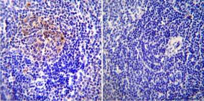 Immunohistochemistry-Paraffin: ICAM-1/CD54 Antibody (3E2B) - Azide and BSA Free [NBP2-22540]