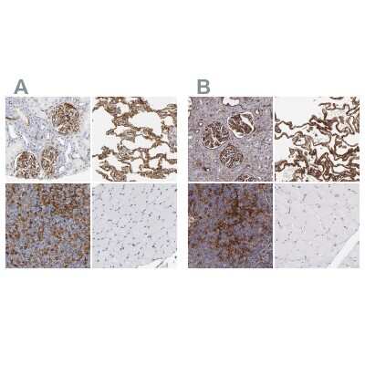 Immunohistochemistry-Paraffin: ICAM-1/CD54 Antibody [NBP1-88700]