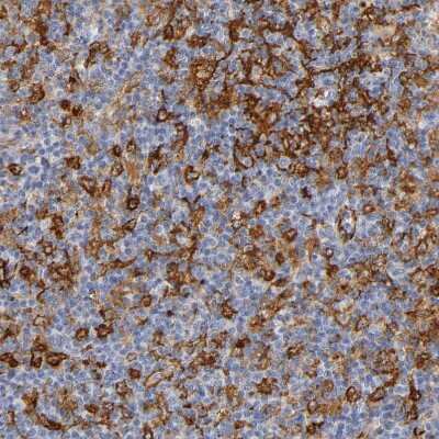 Immunohistochemistry-Paraffin: ICAM-1/CD54 Antibody [NBP1-88700]