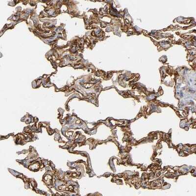 Immunohistochemistry-Paraffin: ICAM-1/CD54 Antibody [NBP1-88700]