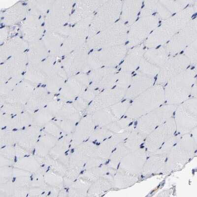Immunohistochemistry-Paraffin: ICAM-1/CD54 Antibody [NBP1-88700]