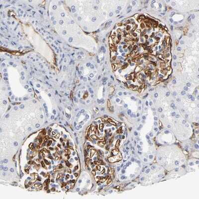 Immunohistochemistry-Paraffin: ICAM-1/CD54 Antibody [NBP1-88700]