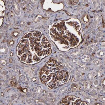 Immunohistochemistry-Paraffin: ICAM-1/CD54 Antibody [NBP1-88701]
