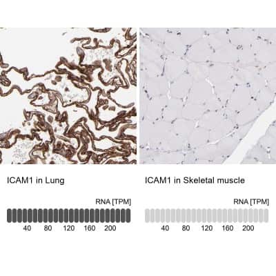 Immunohistochemistry-Paraffin: ICAM-1/CD54 Antibody [NBP1-88701]