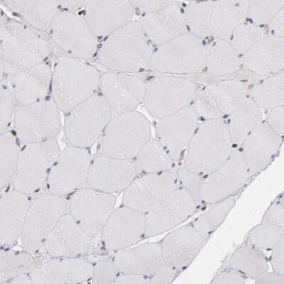 Immunohistochemistry-Paraffin: ICAM-1/CD54 Antibody [NBP1-88701]