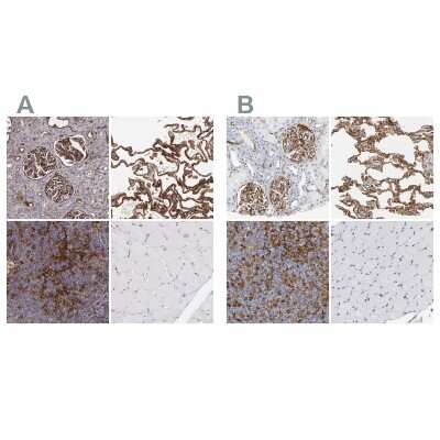 Immunohistochemistry-Paraffin: ICAM-1/CD54 Antibody [NBP1-88701]