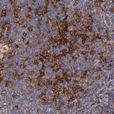Immunohistochemistry-Paraffin: ICAM-1/CD54 Antibody [NBP1-88701]