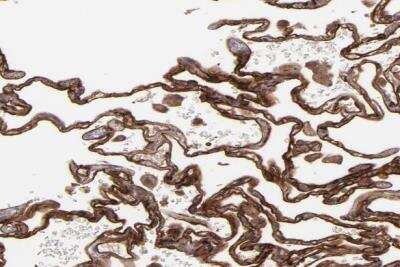 Immunohistochemistry-Paraffin: ICAM-1/CD54 Antibody [NBP1-88701]