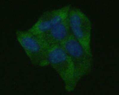 Immunocytochemistry: ICAM-1/CD54 Antibody (J0-F7) [NBP2-66896]