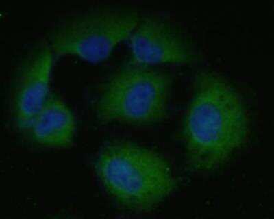 Immunocytochemistry: ICAM-1/CD54 Antibody (J0-F7) [NBP2-66896]