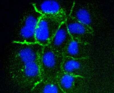 Immunocytochemistry/ Immunofluorescence: ICAM-1/CD54 Antibody (ST0487) [NBP2-67518]