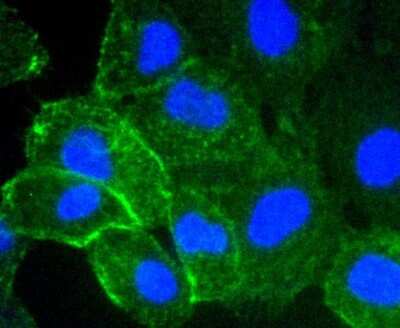 Immunocytochemistry/ Immunofluorescence: ICAM-1/CD54 Antibody (ST0487) [NBP2-67518]