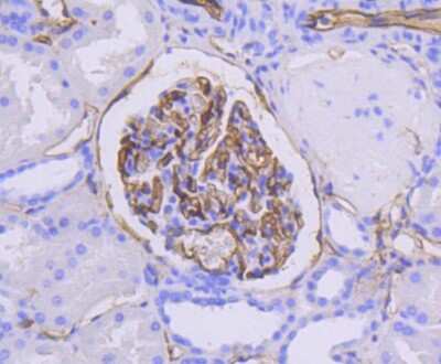 Immunohistochemistry-Paraffin: ICAM-1/CD54 Antibody (ST0487) [NBP2-67518]