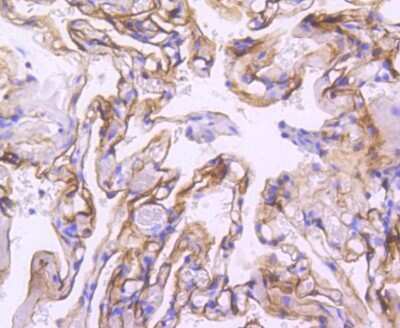 Immunohistochemistry-Paraffin: ICAM-1/CD54 Antibody (ST0487) [NBP2-67518]