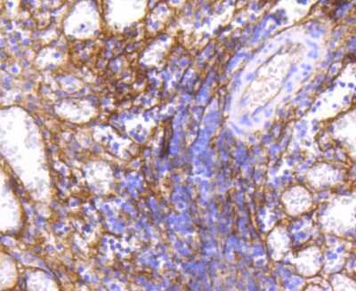 Immunohistochemistry-Paraffin: ICAM-1/CD54 Antibody (ST0487) [NBP2-67518]