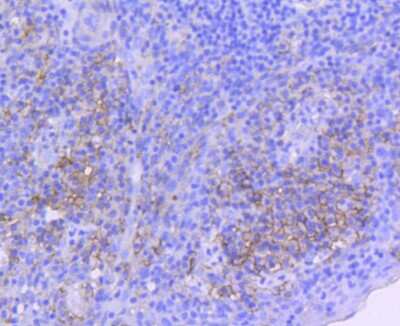 Immunohistochemistry-Paraffin: ICAM-1/CD54 Antibody (ST0487) [NBP2-67518]