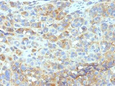 Immunohistochemistry-Paraffin: ICAM-1/CD54 Antibody (W-CAM-1 (same as Wehi-CAM-1 or 1H4)) - IHC-Prediluted [NBP2-48214]