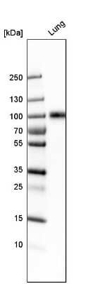 Western Blot: ICAM-1/CD54 Antibody [NBP1-88700]