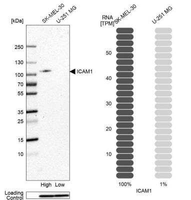 Western Blot: ICAM-1/CD54 Antibody [NBP1-88701]