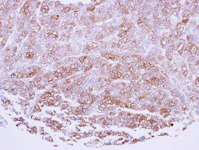 Immunohistochemistry-Paraffin: ICAM-2/CD102 Antibody [NBP1-31612]