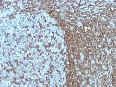 Immunohistochemistry-Paraffin: ICAM-3/CD50 Antibody (ICAM3/1019) - Azide and BSA Free [NBP2-47903]