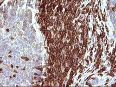 Immunohistochemistry: ICAM-3/CD50 Antibody (OTI1E7) - Azide and BSA Free [NBP2-70975]
