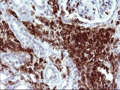 Immunohistochemistry: ICAM-3/CD50 Antibody (OTI1E7) - Azide and BSA Free [NBP2-70975]