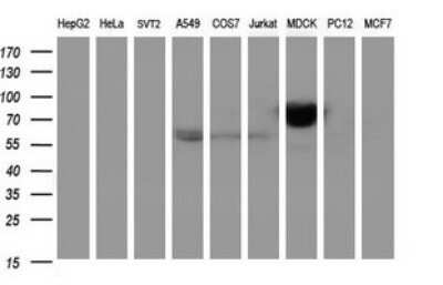 Western Blot: ICAM-3/CD50 Antibody (OTI1E7)Azide and BSA Free [NBP2-70975]