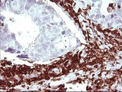 Immunohistochemistry: ICAM-3/CD50 Antibody (OTI1E7) [NBP2-46010]