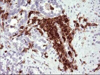 Immunohistochemistry: ICAM-3/CD50 Antibody (OTI1E7) [NBP2-46010]