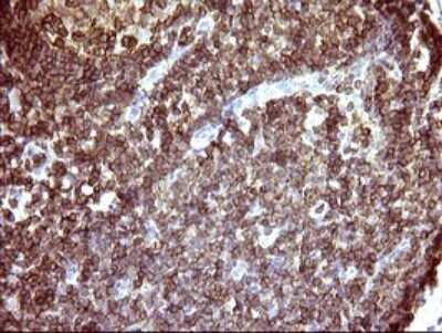 Immunohistochemistry: ICAM-3/CD50 Antibody (OTI1E7) [NBP2-46010]