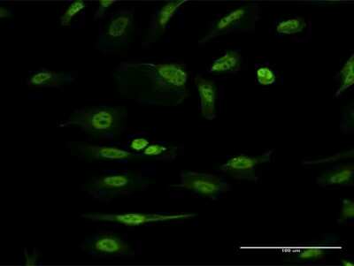 Immunocytochemistry/ Immunofluorescence: ICAP-1 Antibody (3B2) [H00009270-M09]