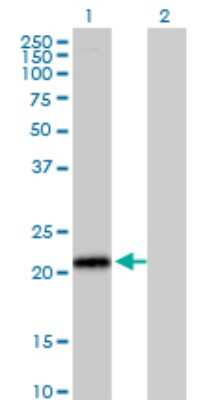 Western Blot: ICAP-1 Antibody (3B2) [H00009270-M09]