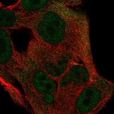 Immunocytochemistry/ Immunofluorescence: ICAP-1 Antibody [NBP2-57261]