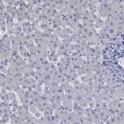 Immunohistochemistry-Paraffin: ICAT/CTNNBIP1 Antibody [NBP3-17057]