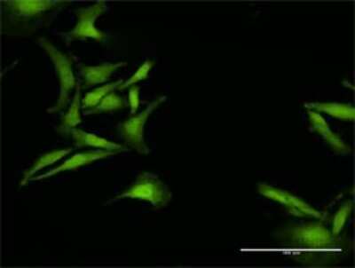 Immunocytochemistry/ Immunofluorescence: ICB1 Antibody [H00009473-D01P]