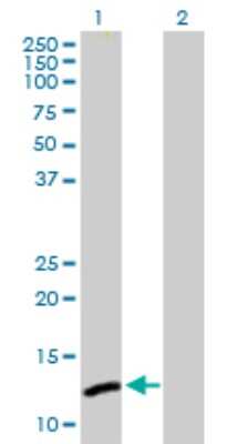 Western Blot: ICB1 Antibody [H00009473-D01P]