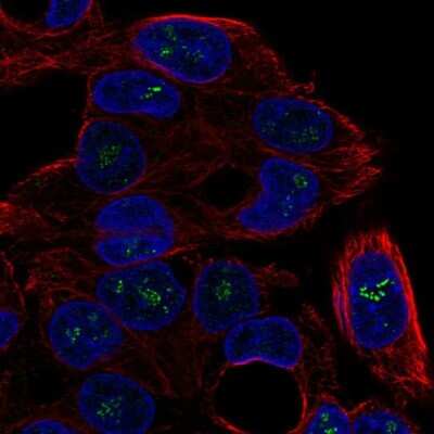 Immunocytochemistry/ Immunofluorescence: ICK Antibody [NBP2-68573]