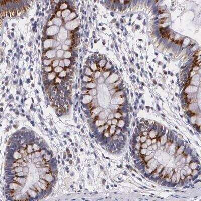 Immunohistochemistry-Paraffin: ICK Antibody [NBP1-81459]